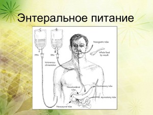 Энтеральное питание   зачем оно используется